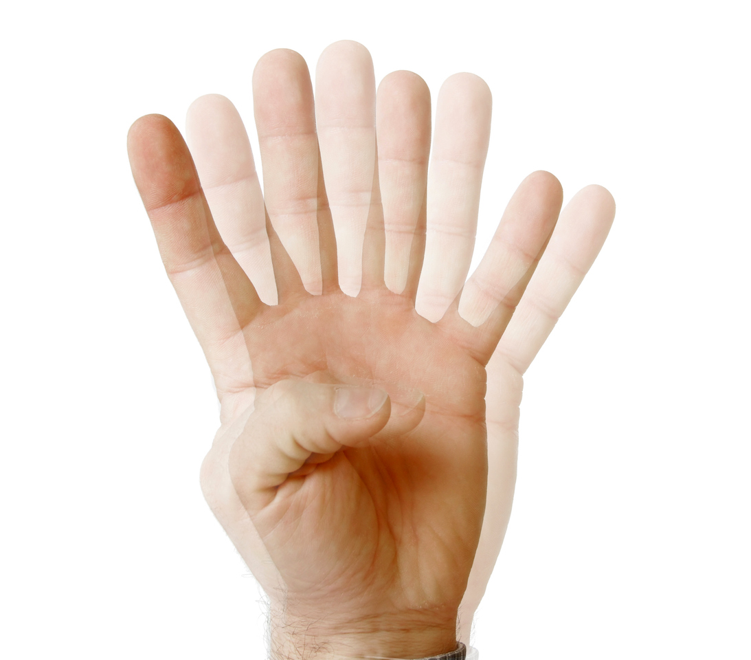 Overlapping images of a raised hand illustrating how double vision can appear